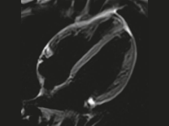 Cardiac Diagnostic Imaging