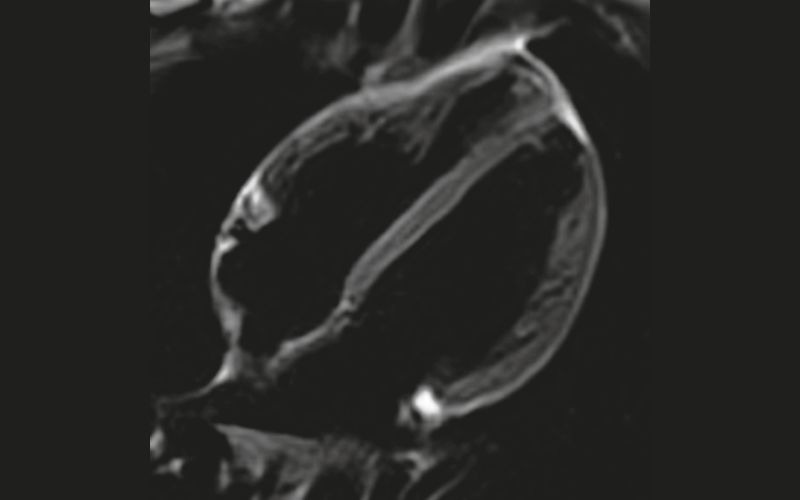 Cardiac Diagnostic Imaging