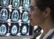 Diagnoses Typically Found by MRI Scans