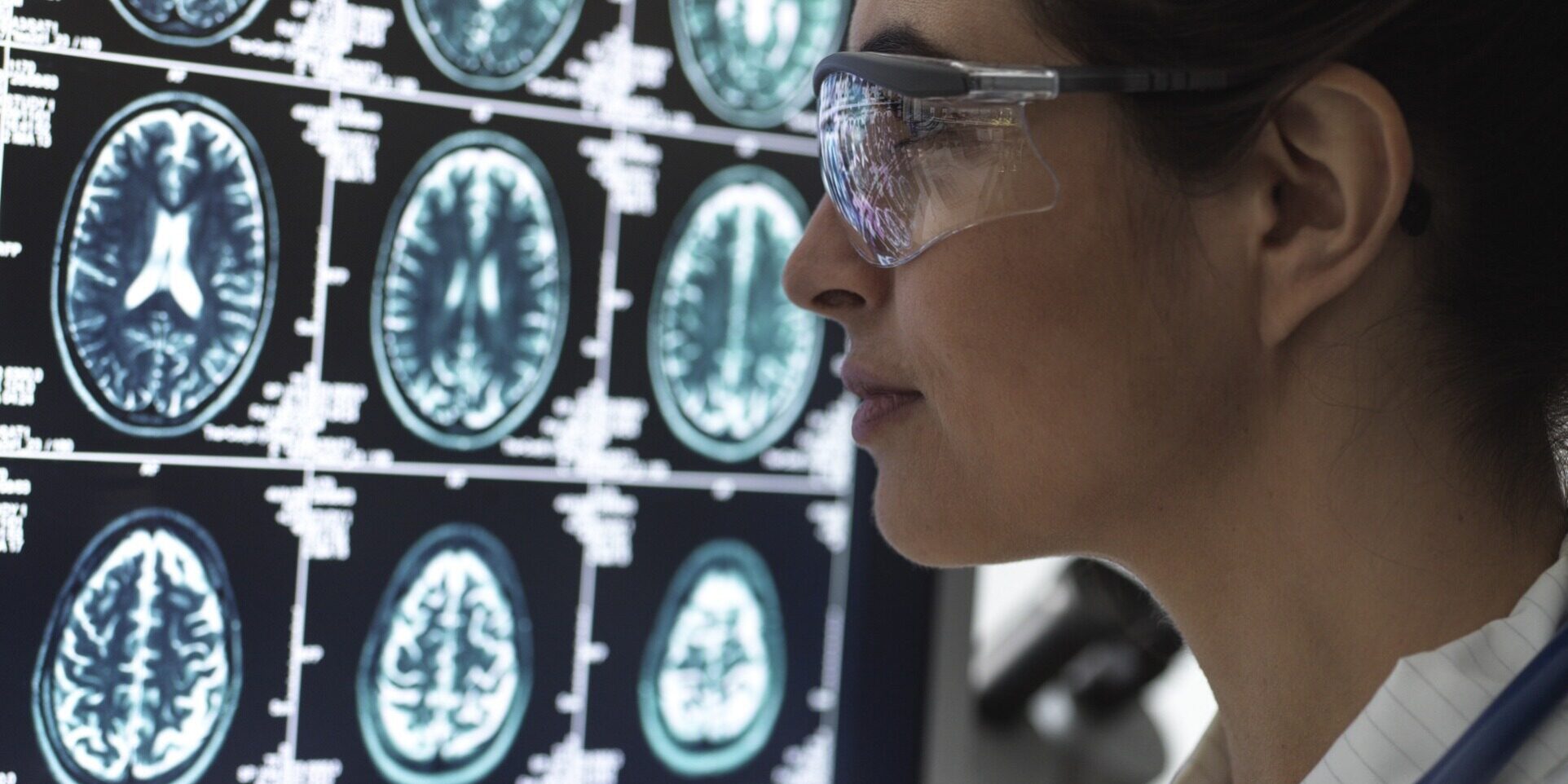 Diagnoses Typically Found by MRI Scans