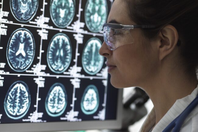 Diagnoses Typically Found by MRI Scans