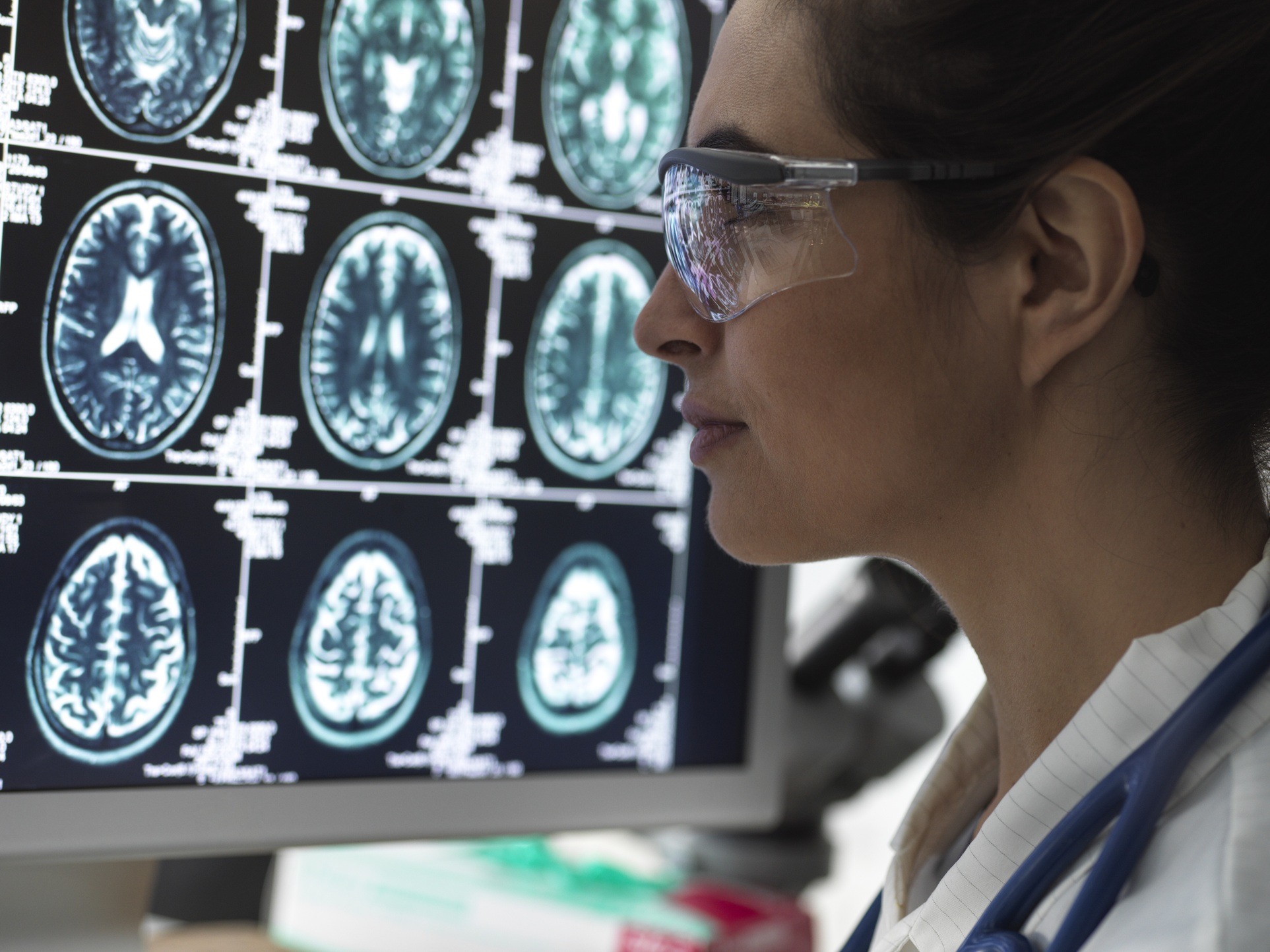 Diagnoses Typically Found by MRI Scans | KCAI