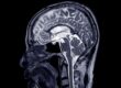 Diagnostic Imaging Neurosurgery