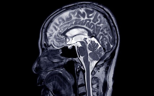 Diagnostic Imaging Neurosurgery