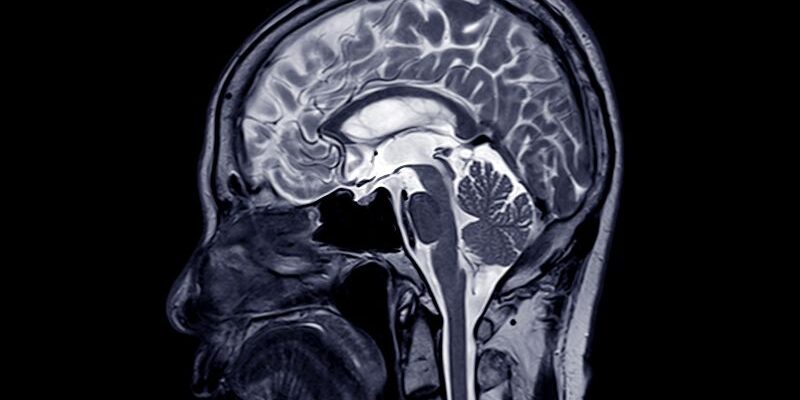 Diagnostic Imaging Neurosurgery