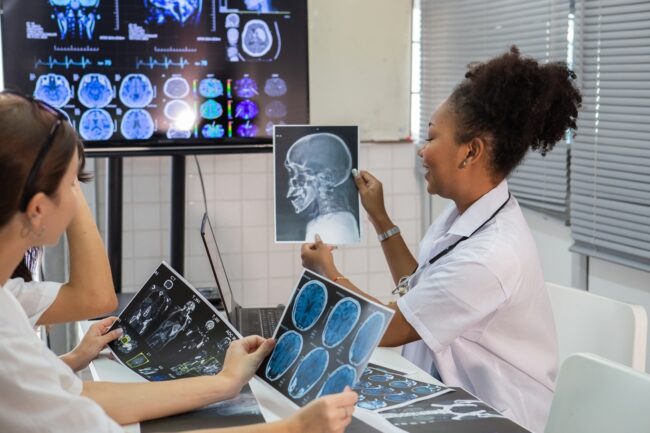 How Imaging Helps Personalize Neurological Treatment Plans blog image