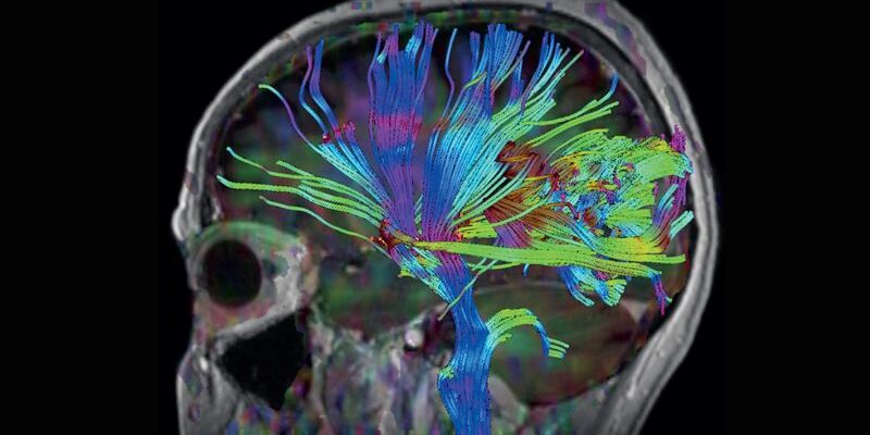 Neurology Brain MRI Scan Neurology Brain MRI Scan