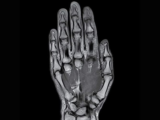 Orthopedic Hand MRI Diagnostic Imaging