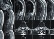 The Benefits of High-Resolution Imaging for Complex Cases