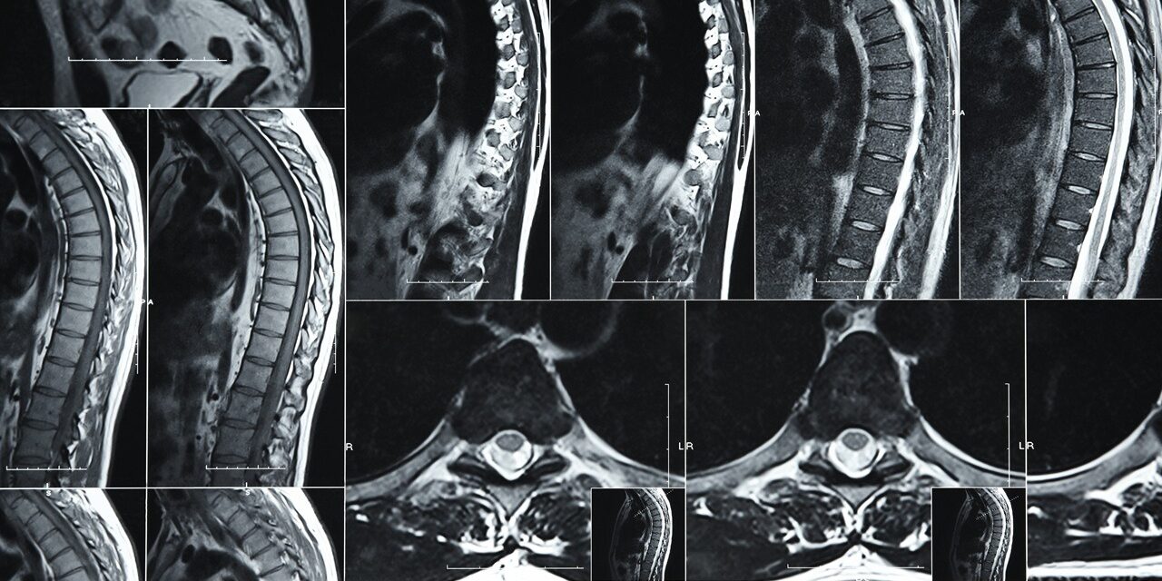 The Benefits of High-Resolution Imaging for Complex Cases
