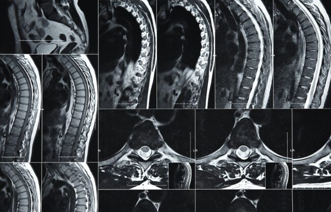 The Benefits of High-Resolution Imaging for Complex Cases The Benefits of High-Resolution Imaging for Complex Cases