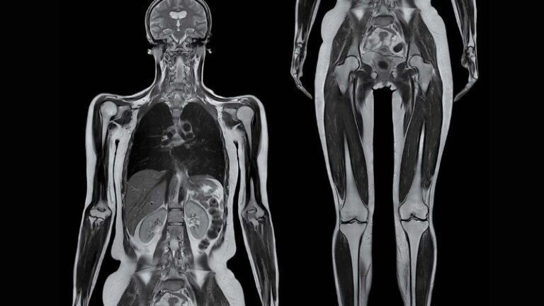 Whole Body MRI Diagnostic Imaging